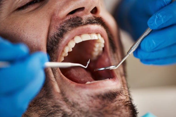 Best Knocked-Out Tooth Emergency  in Wilberforce, OH