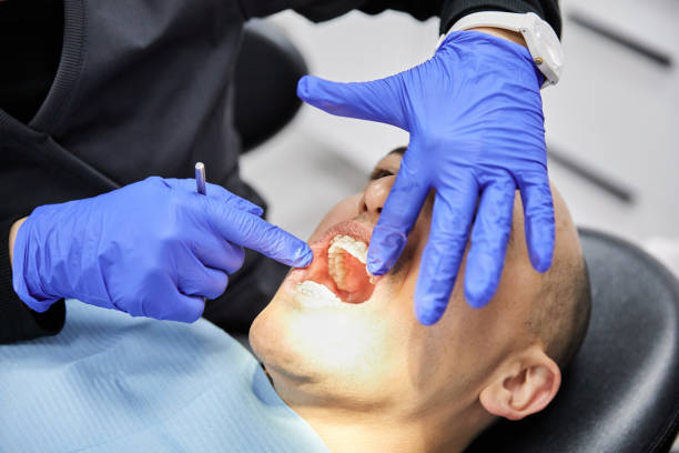 Best Chipped Tooth Repair Near Me  in Wilberforce, OH