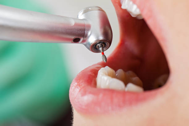 Best Dentist for Tooth Abscess  in Wilberforce, OH
